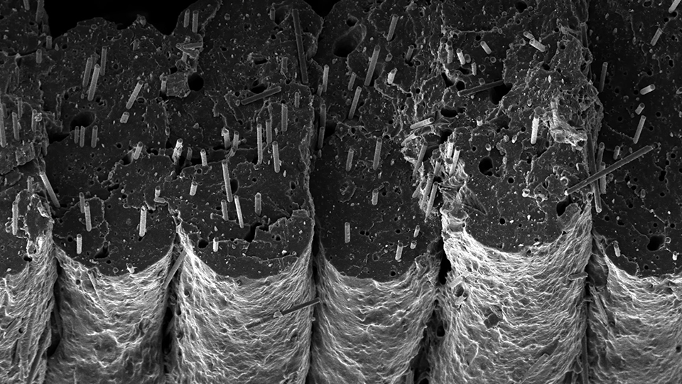 cf ct scan